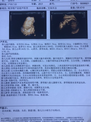 33周宝宝4斤正常吗