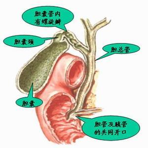 胆管结石怎么治疗