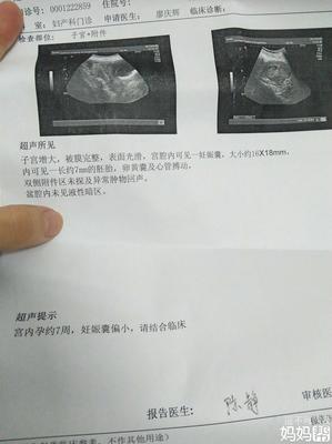 孕酮吃多了对胎儿有影响吗