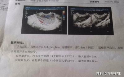 没有成熟的卵泡会怀孕吗