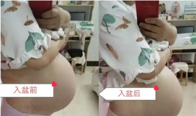 怎样判断胎儿是否入盆