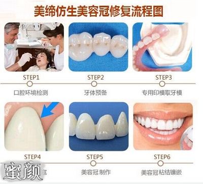 不拔牙可以矫正牙齿吗