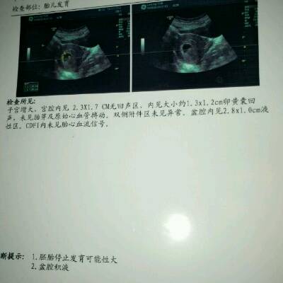 怀孕七周的症状和表现