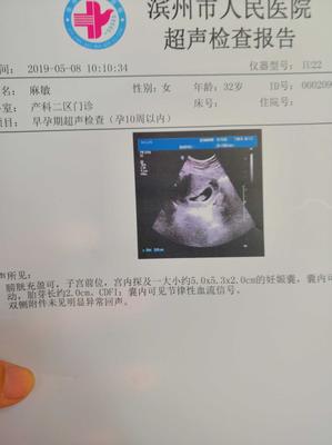 怀孕8周胎儿图片欣赏