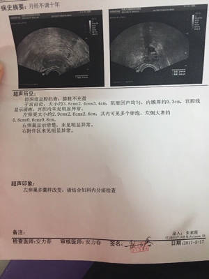 卵巢多囊样改变怎么治疗