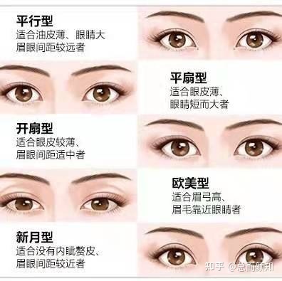 做双眼皮的形状