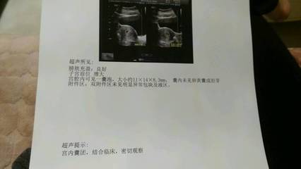 怀孕一个月内会出血吗