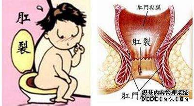 怎么治疗便秘