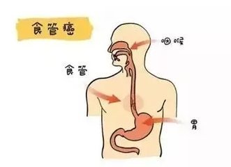 偶尔食道疼是怎么回事