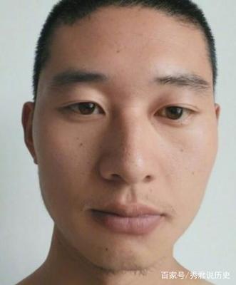 人中歪斜的面相