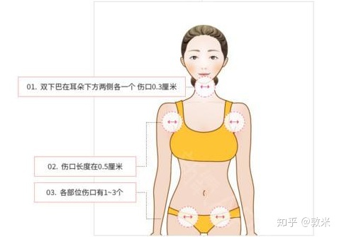 抽脂的危害
