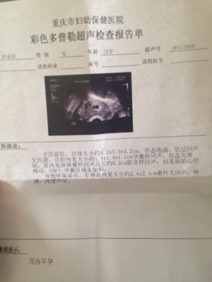 怀孕流褐色血