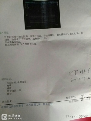 胎儿32周脐带绕颈一周怎么办