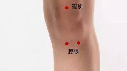 腿关节疼怎么办
