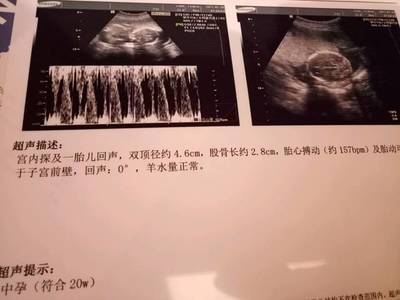 宝宝几周有胎心