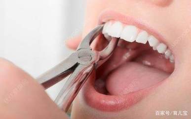 孕妇牙痛怎么快速止痛