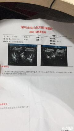 怀孕50天有胎心吗