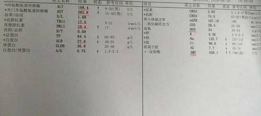 尿淀粉酶偏高多少是胰腺炎