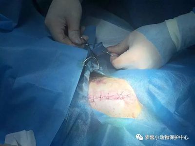 盆骨骨折怎么治疗