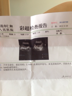 怀孕35天能看到孕囊吗