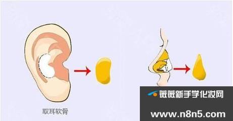 取耳软骨隆鼻疼吗