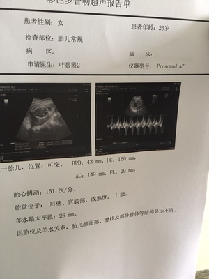 二十周的胎儿有多大