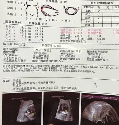 怀孕两个月宝宝多大