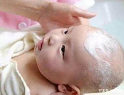 新生儿乳痂图片