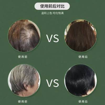 不伤头皮的染发剂