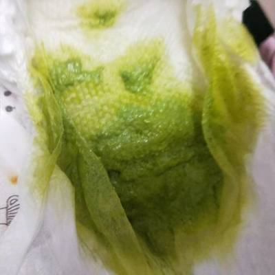 拉的粑粑是绿色的怎么回事