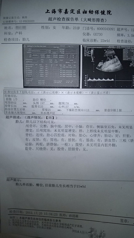 上海b超大畸形筛查多少钱