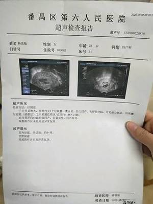 怀孕一个月内会出血吗