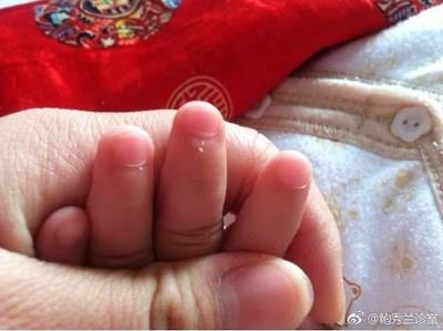 宝宝手倒刺缺什么营养