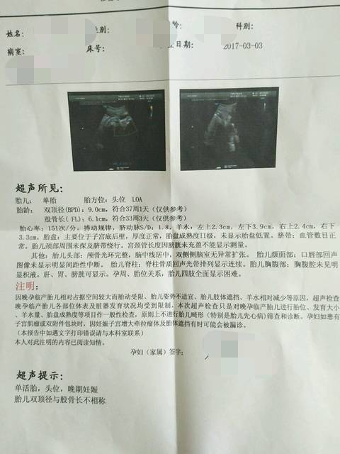 33周胎儿发育情况