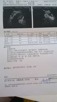 孕30周头大多少正常值