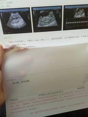 怀孕三个月见红了怎么办