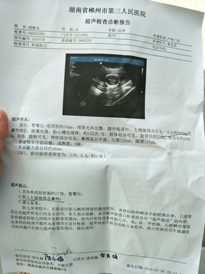 胎儿在左边