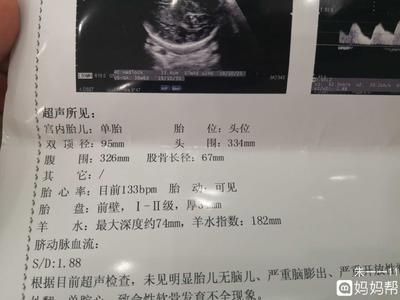36周胎儿双顶径