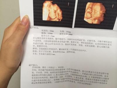 孕妇需要做心脏彩超吗