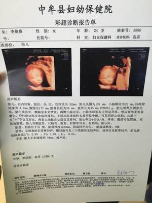 四个月可以做四维彩超吗