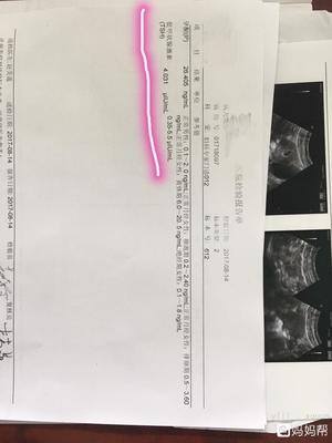 怀孕甲状腺检查