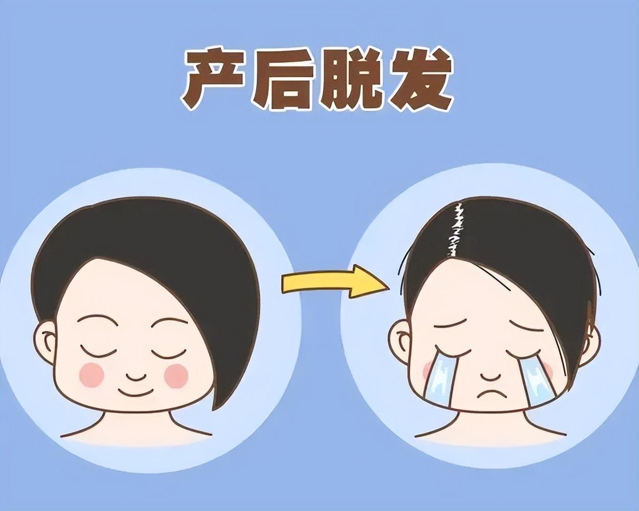 孕妇 掉头发