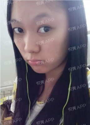 祛痘痘痘印的app软件