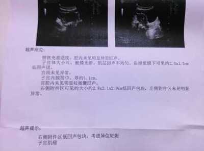怎么看怀孕没