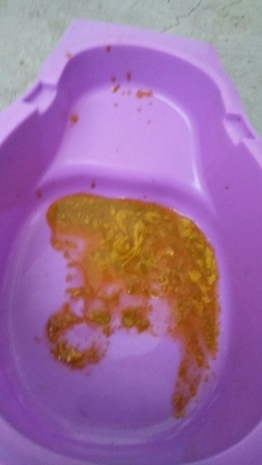 宝宝一天拉三次大便有点稀薄