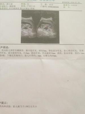 怀孕两个月头疼