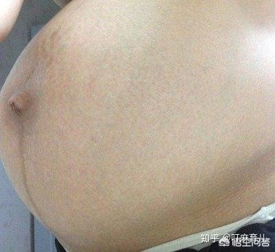 小腹下坠是怎么回事