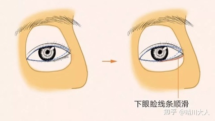开眼角下至