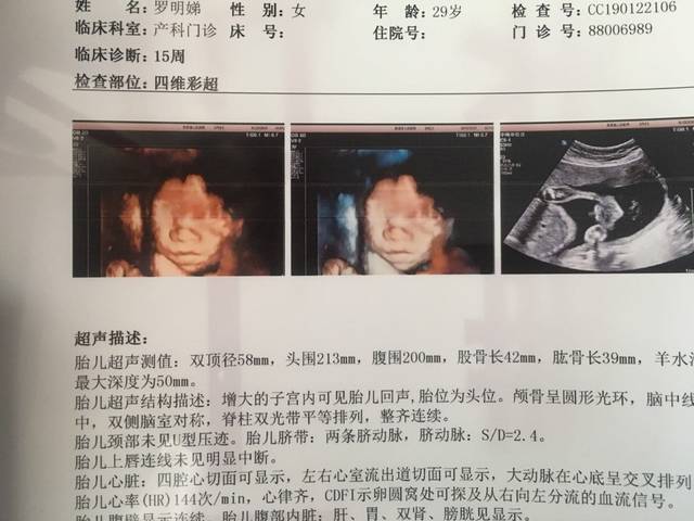 胎儿双顶径标准看男女