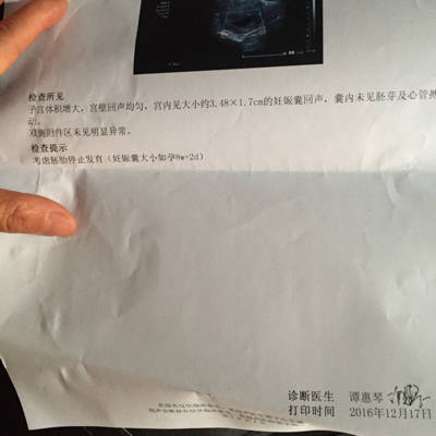 怀孕十一周有什么症状